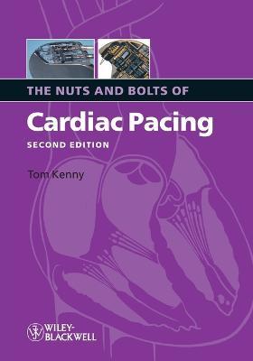 Nuts and Bolts of Cardiac Pacing 2e