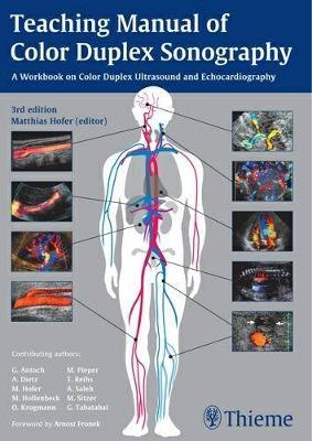 Teaching Manual of Color Duplex Sonography