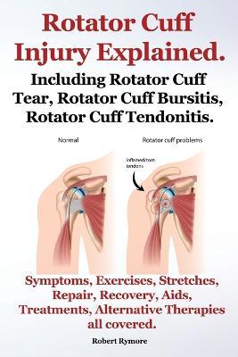 Rotator Cuff Injury Explained. Including Rotator Cuff Tear, Rotator Cuff Bursitis, Rotator Cuff Tendonitis. Symptoms, Exercises, Stretches, Repair, Recovery, Aids, Treatments, Alternative Therapies all covered.