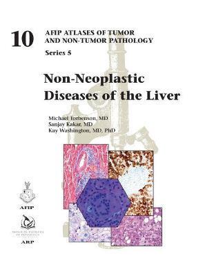 NON-NEOPLASTIC DISEASES OF THE LIVER