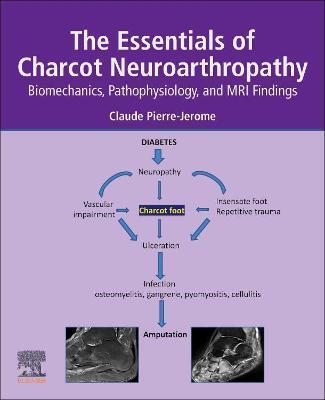 ESSENTIALS OF CHARCOT NEUROARTHROPATHY